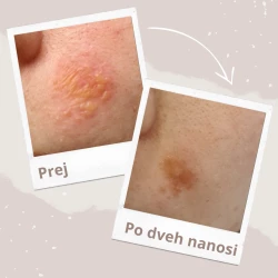 KOLOSTRUM GEL SOLIME, 15 ML