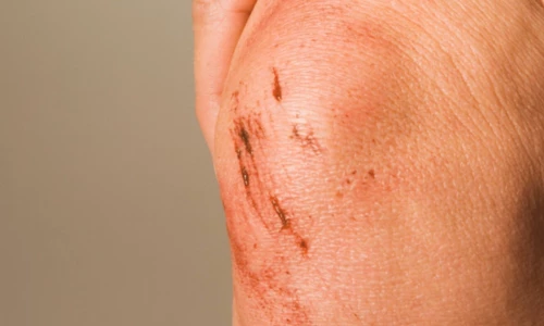 Kolostrum – prva naravna obramba za vaš imunski sistem Kolostrum – prva naravna obramba za vaš imunski sistem