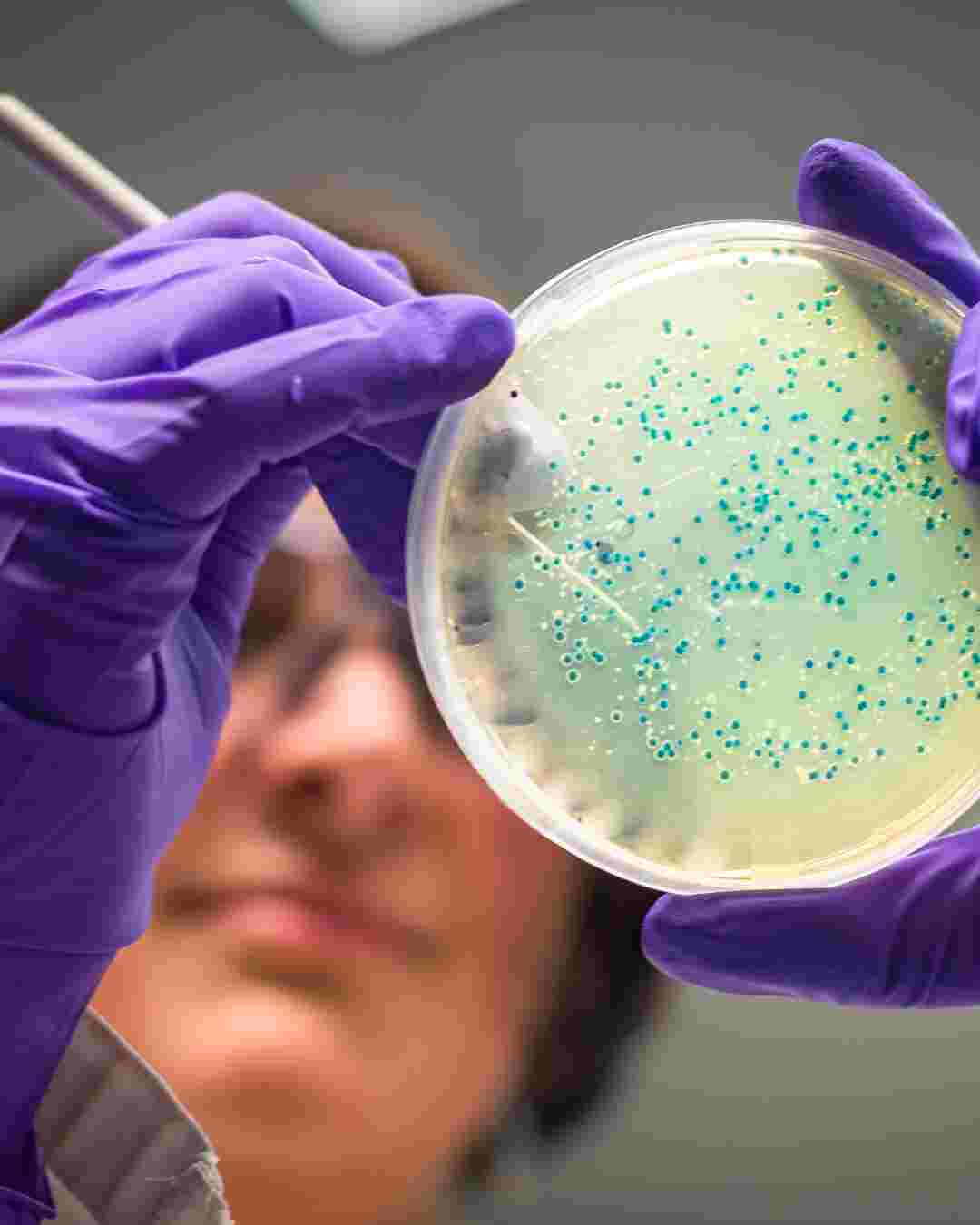 Laboratorijska analiza bakterij črevesne mikrobiote v petrijevki.